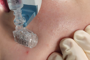 步驟03說明圖-修秘魔筆煥顏